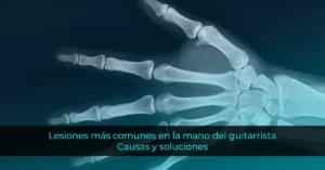 Lesiones más comunes en la mano del guitarrista: Causas y soluciones